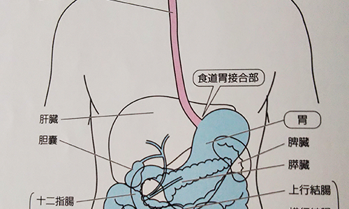 i_kettyo