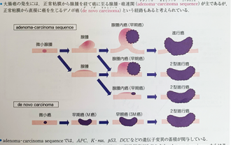 carcinoma