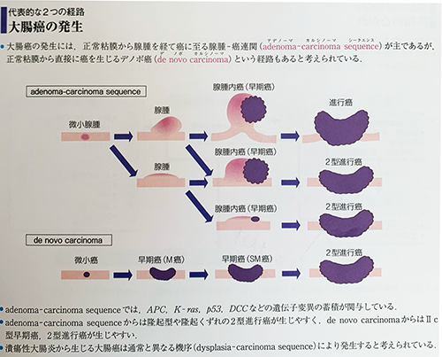 carcinoma